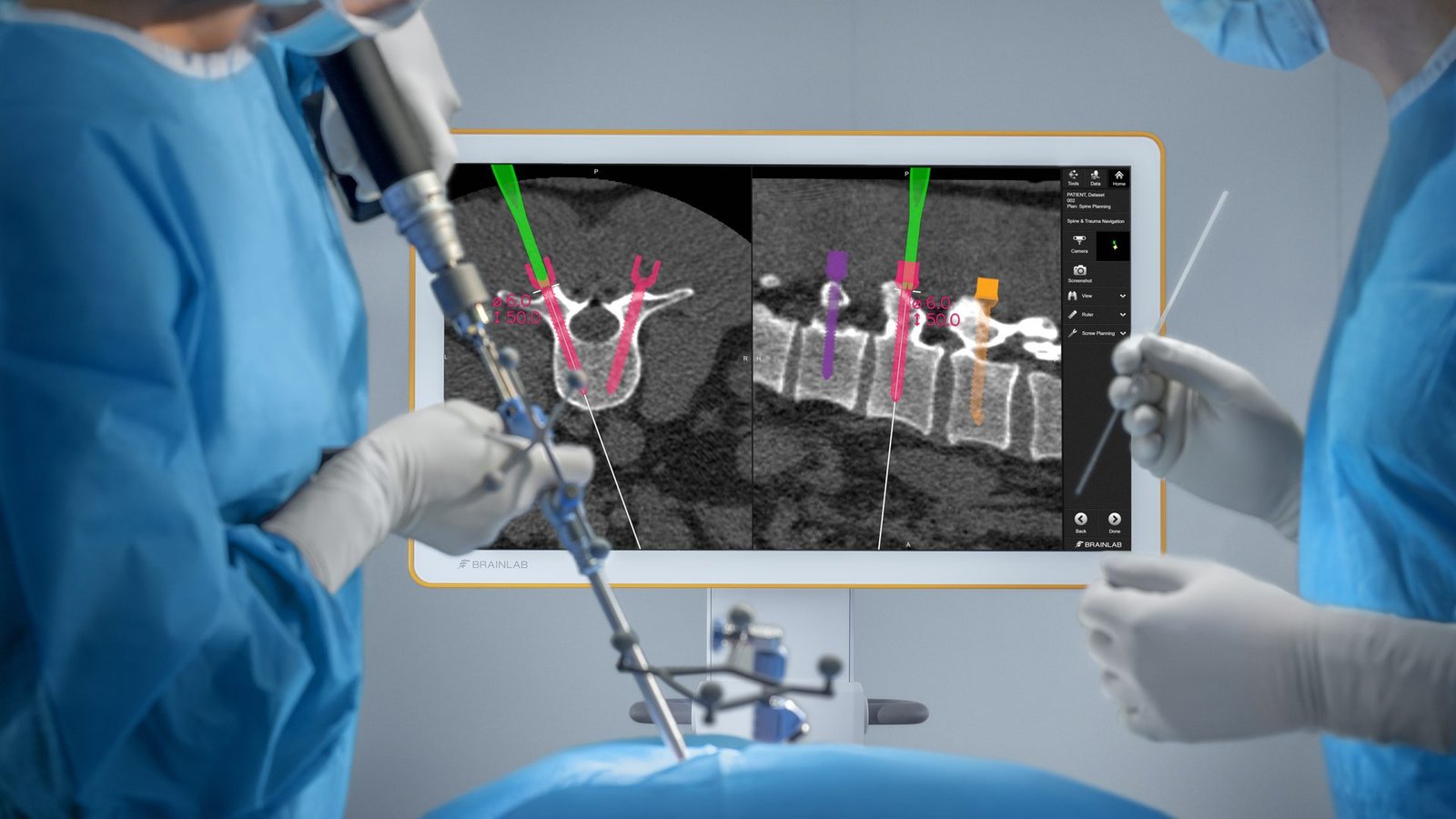 Brainlab spine navigation guiding instrument placement during a posterior spinal procedure