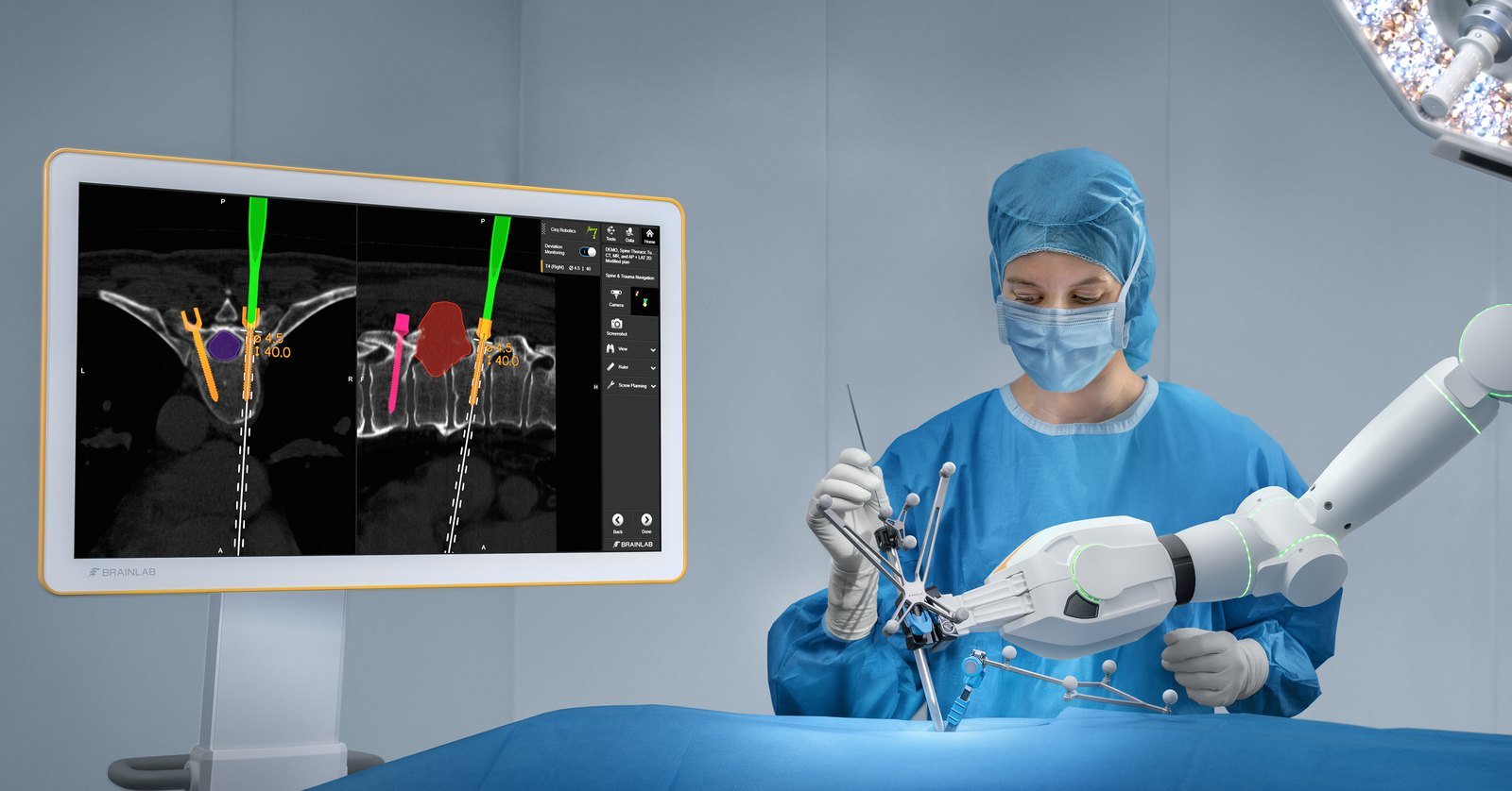 Surgeon using Brainlab spine navigation with a Cirq robotic arm to place pedicle screws